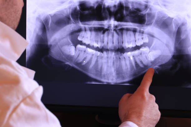 Best Emergency Treatment for Dental Infections or Abscesses in Fresno, CA